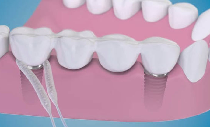 pierderea în greutate de igienă dentară pierderea mea de greutate md recenzii