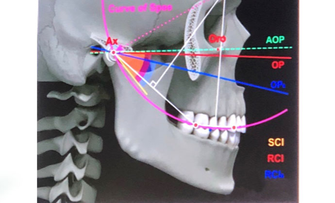 articulatii maxilar