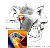 dureri articulare datorate dinților dureri ascuțite în zona șoldului