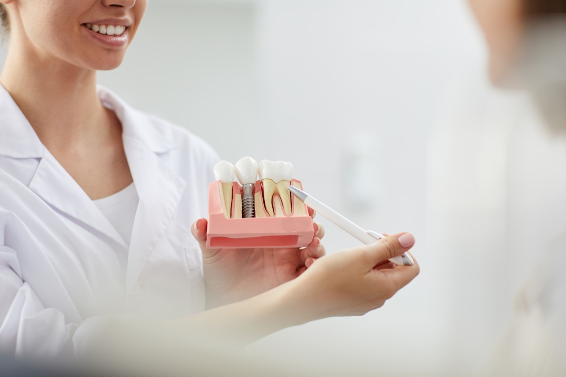 cat costa un implant dentar