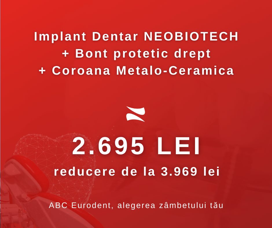 opțiuni binare de la 10 depozit