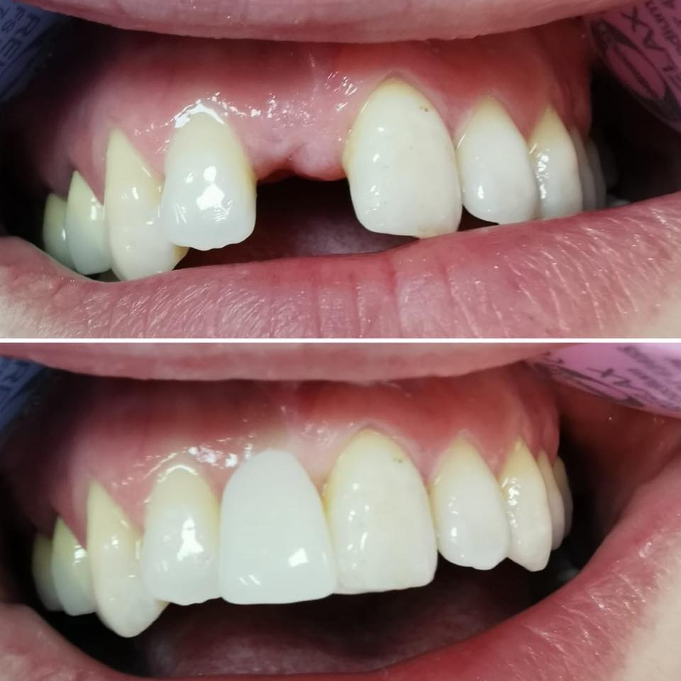 clinica implant dentar drumul taberei