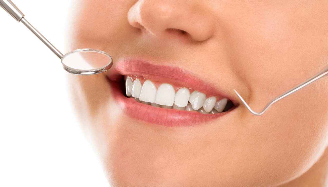 plombe dentare estetice aspect natural