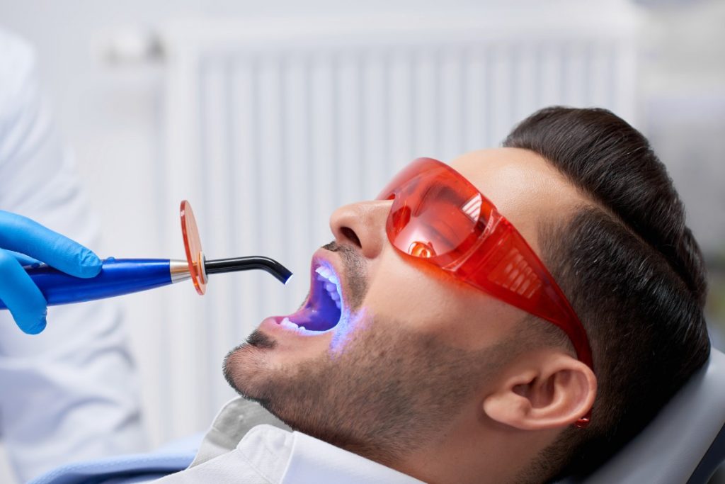 procedura plombe dentare estetice