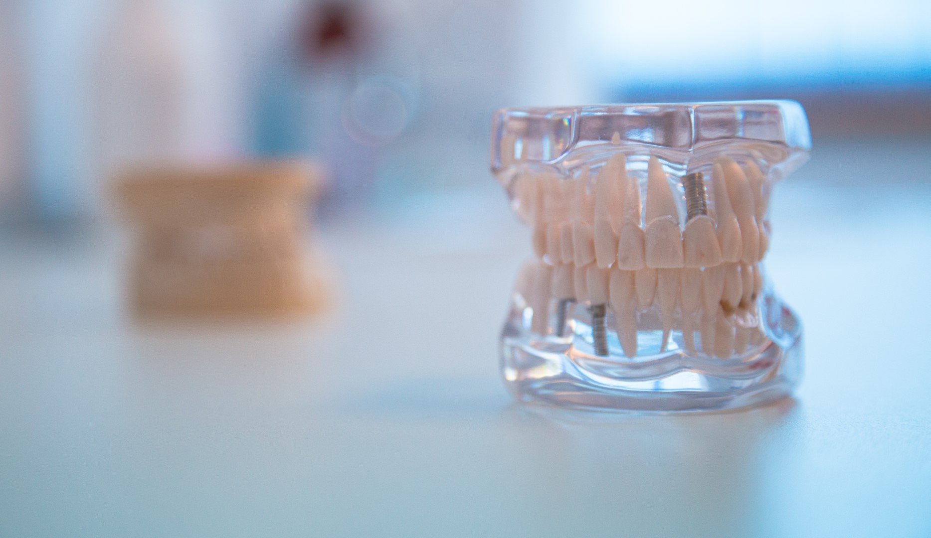 implant dentar ieftin
