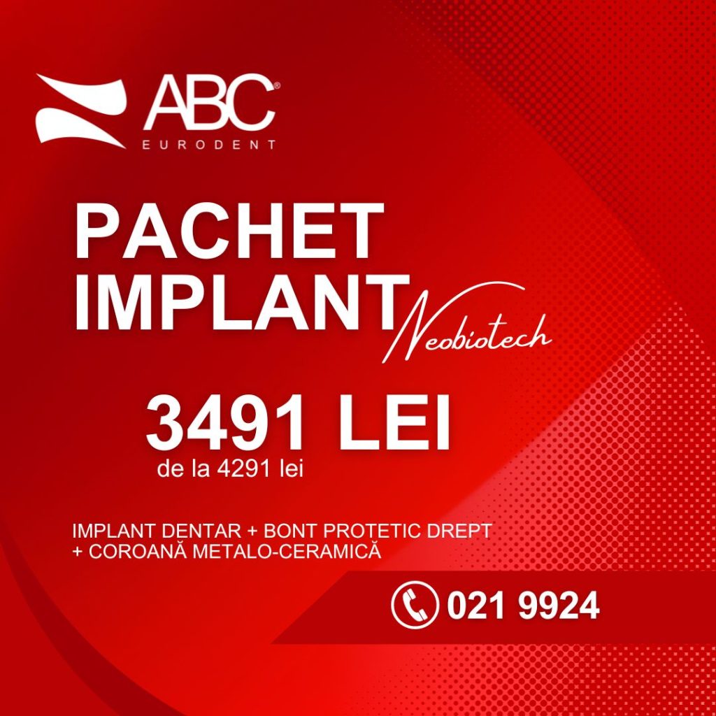 implant dentar bucuresti_sept 2023